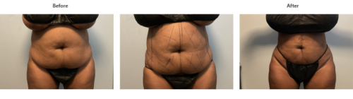 Patient-Before-after
